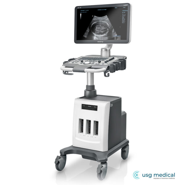 Mindray DC30 Full HD